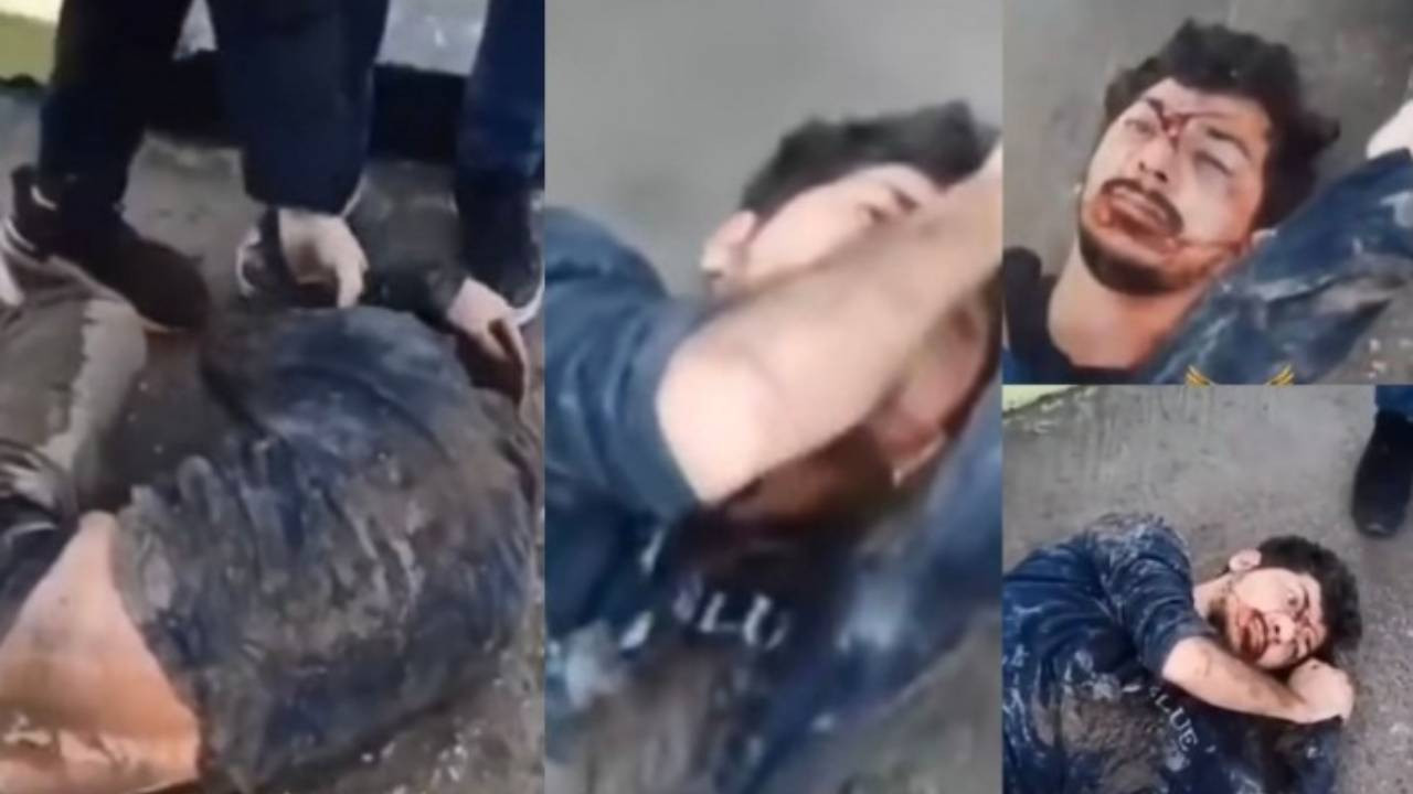 Nusaybin'de işkence edilen Diyar Koç hayati riske rağmen savcılığa sevk edildi