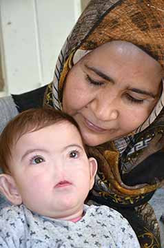 Doğuştan burunsuz dünyaya geldiler: Kızlarım nefes alsın - Resim : 1