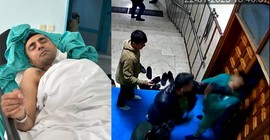 Dünya şampiyonu kick boksçunun dövdüğü cami görevlisinin çenesi kırıldı, yüz felci geçirdi