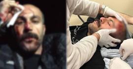 Polisler önce müvekkilini sonra avukatı darp ettiler