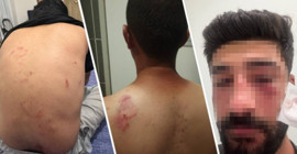 Kürtçe konuşanlara ırkçı saldırıda bulunanlar serbest bırakıldı