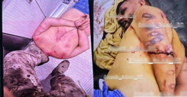 Polis baskınındaki işkencenin fotoğrafları ortaya çıktı