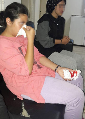 Villanın bahçesinden 3 tane mısır alan 3 kız çocuğu darp edildi - Resim : 1