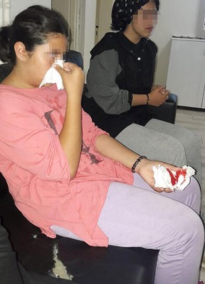 Villanın bahçesinden 3 tane mısır alan 3 kız çocuğu darp edildi - Resim : 1