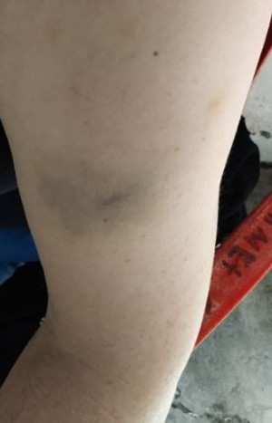 Tutuklu annesi polis tarafından darp edildi - Resim : 1