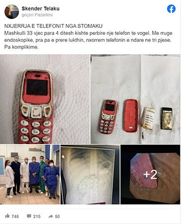 Bir kişinin midesinden Nokia 3310 çıkarıldı - Resim : 1