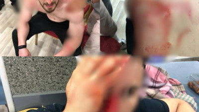 Adalet Sarayı şantiyesinde çalışan ve ücretlerini isteyen işçilere saldırı: En az üç yaralı