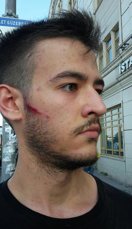 Otobüs şoförü genci darp etti - Resim : 2