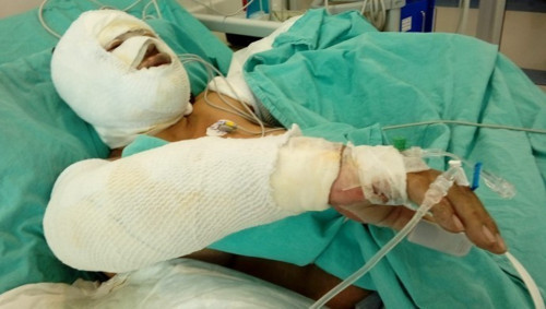 Ö.E. adlı erkek, uzaklaştırma kararına rağmen Y.D adlı kadını benzin ile yakıp koridorda izledi - Resim : 1