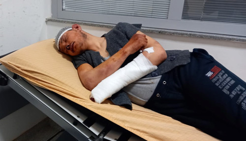 Eski işvereninden 200 lira alacağını isteyen 16 yaşındaki çocuk, 5 saat boyunca dövüldü - Resim : 1
