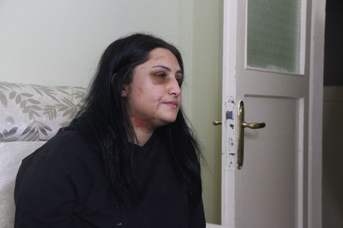 Çocuğunun yanında öldürülesiye darp edilen kadın o anları anlattı: İkinci bir şans vermemek lazım - Resim : 2