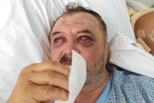 İşkenceyi haber yaptıkları için tutuklanan 4 gazeteci 175 gün sonra hakim karşısına çıkıyor - Resim : 1