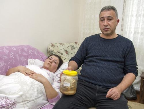 Karnından 3 yıl önce unutulan gazlı bezler çıktı. - Resim : 2