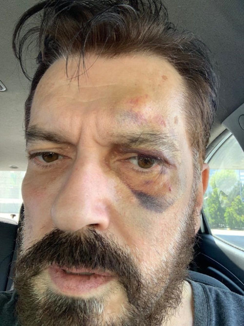 Hakan Bayrakçı saldırıya uğradı: Bir kasıt ve siyasi olduğu belli - Resim : 1
