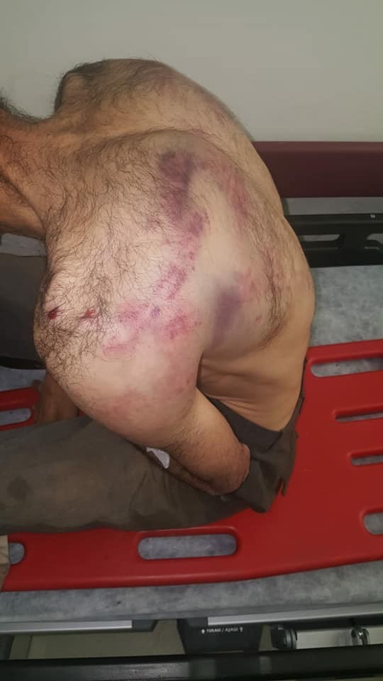 5-6 uzman çavuş iki çobana saatlerce işkence yaptı - Resim : 2