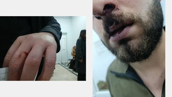 Trafik kurallarına uymayan polisi uyaran gençler darp edildi