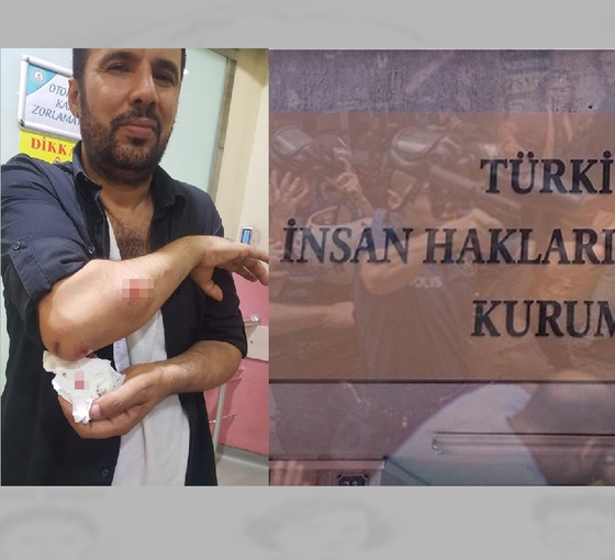 Fail polis olunca TİHEK ayrımcılıkla mücadeleyi 'unuttu'