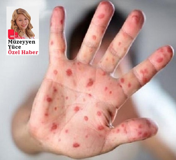 Aşı reddinde korkutan tablo: 7 ilde 200 bin doz aşı yapılamadı, salgın kapıda