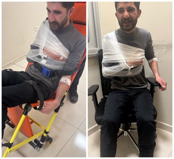 Van'da kayyım protestosunda işkence: Polis omzunu ve parmaklarını kırdı