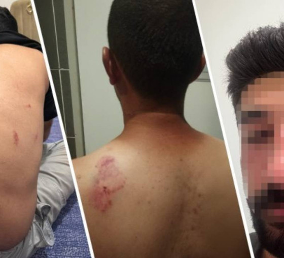 Mersin’de bir aile, Kürtçe konuştukları için saldırıya uğradı: Bir kişi yoğun bakımda
