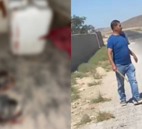 Niğde'de Kürt işçilere saldırı: Bir işçi yoğun bakımda... DEM Parti ve DBP'den açıklama