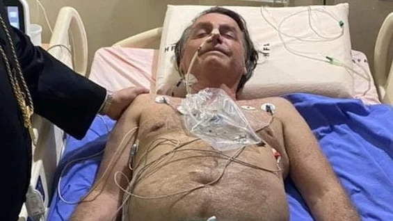 Brezilya Devlet Başkanı Bolsonaro yoğun bakımda - Resim : 1