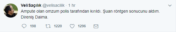 Polis Veli Saçılık'ın ampute kolunu kırdı - Resim : 1