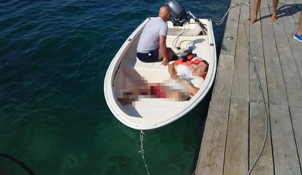 Bodrum'da haber takibi yapan gazetecilere sürat teknesi çarptı - Resim : 1