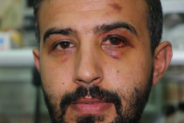 'Polis beni önce darp etti sonra ölümle tehdit etti' - Resim : 1