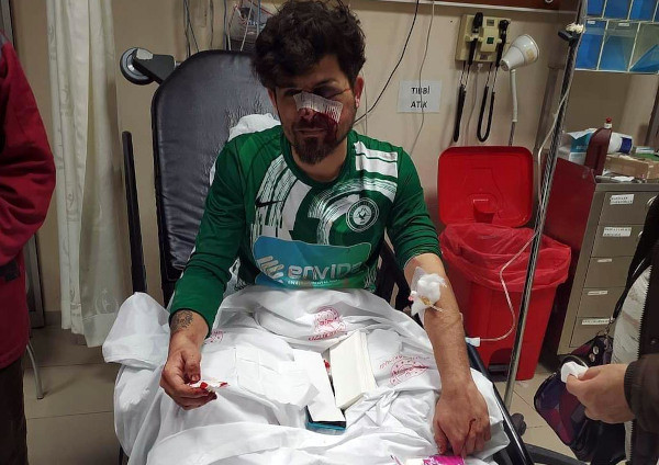 Kırmızı kart gören futbolcu, yerde yatan rakibinin yüzüne tekme atıp yaraladı - Resim : 1