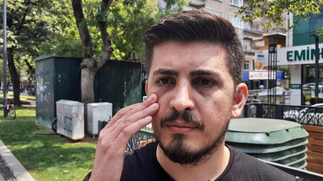 Hemşirenin burnunu kıran zanlı, yakalama kararıyla yeniden gözaltında - Resim : 1