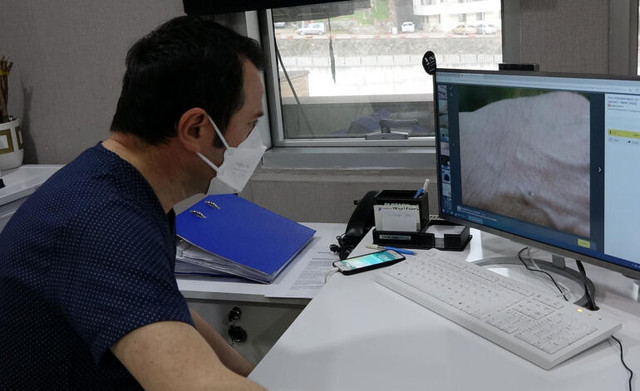 Yurtlarda ‘uyuz’ vakaları arttı: ‘Kaşıntıyı ötelemeyin’ uyarısı - Resim : 1