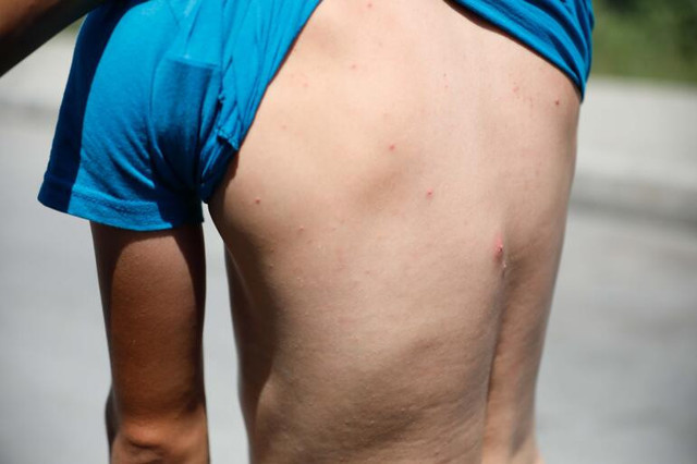 İstanbul'da 'Aedes' türü sivrisinek tehdidi - Resim : 1