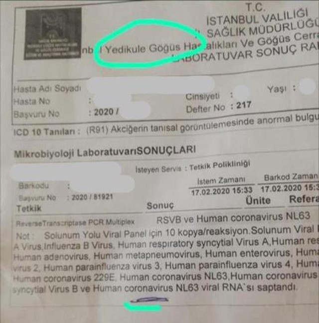 İstanbul’da koronavirüs şüphesi: Bakan Koca’dan açıklama geldi - Resim : 1