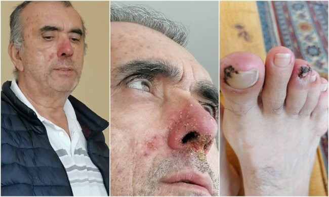 Türkiye, hasta tutukluların ölümüne sessiz: Sırada kim var! - Resim : 4