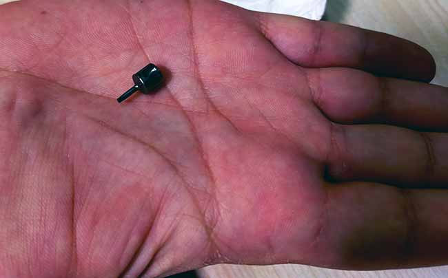 Dişçiye gitti, akciğerine implant parçası kaçtı - Resim : 1