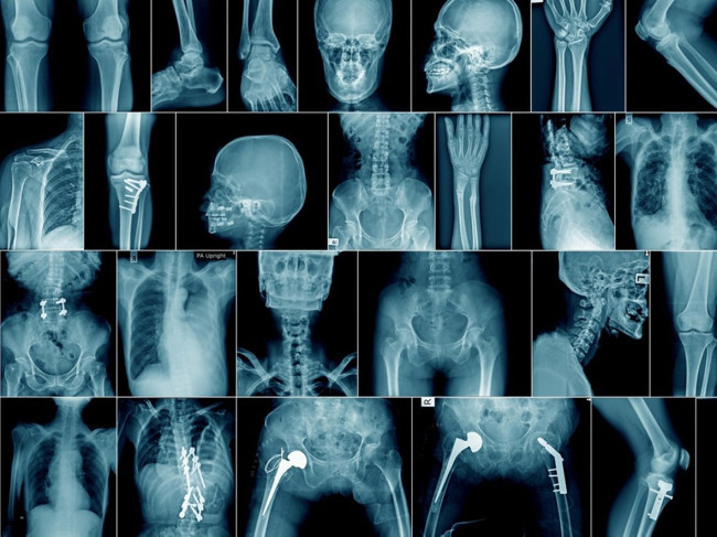 Yapay zeka, X-Ray görüntülerinden insanların ırkını tahmin ediyor; bunun riskleri olabilir - Resim : 1