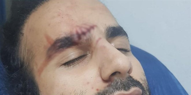 Doktora saldıran sabıkalı serbest bırakıldı - Resim : 1