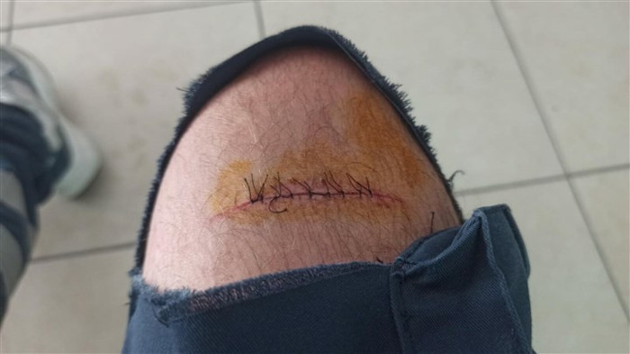 Acil tıp teknisyenini makasla yaralayan şahıs serbest bırakıldı - Resim : 1