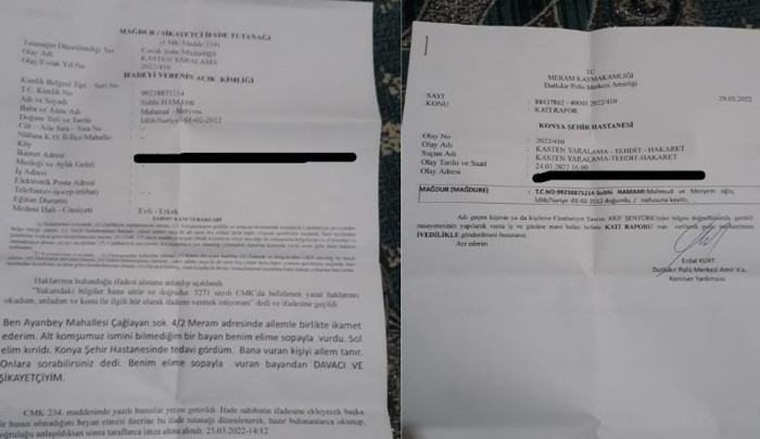 Konya’da Suriyeli aileye baltalı saldırı: 9 yaşındaki çocuğun eli kırılırken, annenin de eli yaralandı - Resim : 2