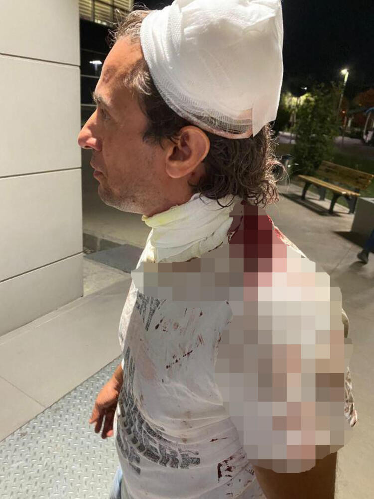 Alkollü yolcu taksi şoförünü ısırdı, darbetti, aracına binip kaza yaptı - Resim : 1