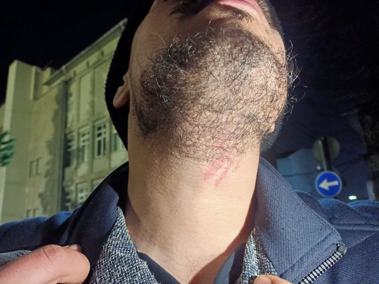 Darp edilerek gözaltına alınan Migros işçileri: 'Bir ekmek parası vermek bu kadar zor mu?' - Resim : 1