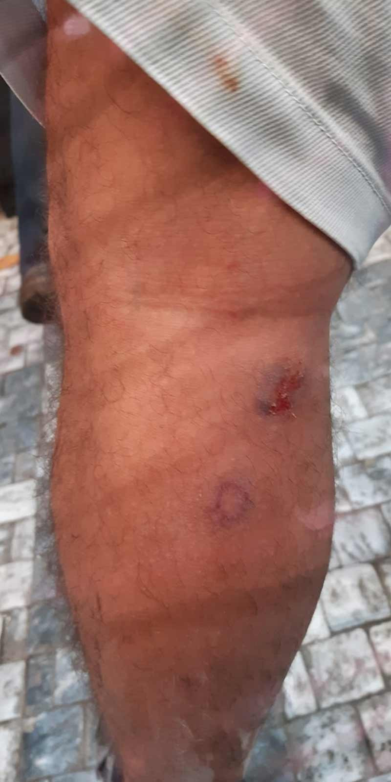 Suruç Katliamı'nın 6. yıldönümünde Kadıköy'de anma: Polis müdahale etti - Resim : 1