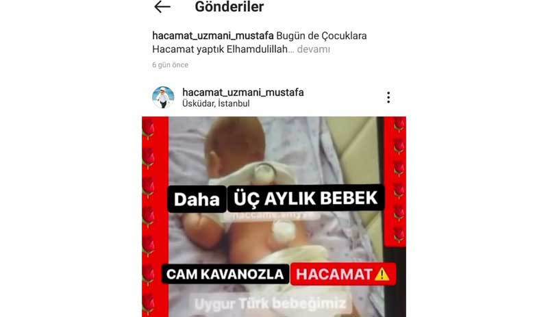 Üsküdar'da bir merkezde bebeklere hacamat yapıldığı ortaya çıktı - Resim : 1