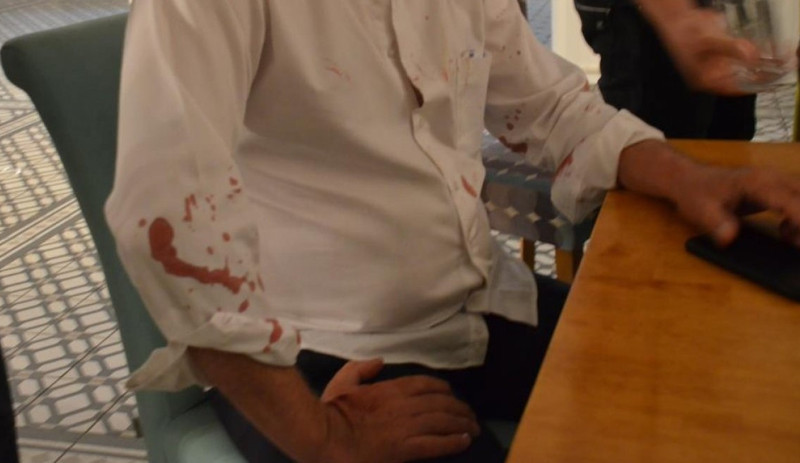 Didim Belediye Başkanı CHP'li Atabay'a saldırı - Resim : 1