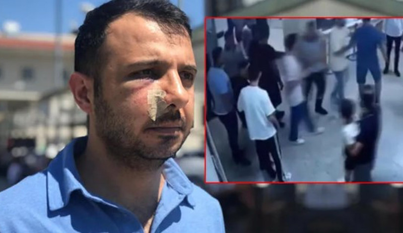 Sağlıkta şiddet durdurulmuyor: İstanbul’da sağlık çalışanlarına saldırı - Resim : 1