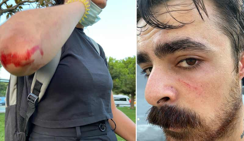 Irkçı katliam engellere rağmen Taksim'de protesto edildi: Faşizme karşı omuz omuza - Resim : 2
