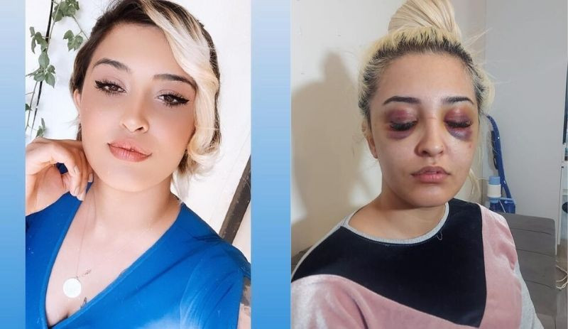 Ayrıldığı erkek tarafından 3 saat boyunca darbedilen kadın: Ölmekten korkuyorum - Resim : 1