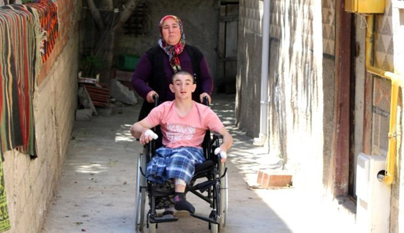 Dünyada bu hastalıkla hayatta kalan tek kişi: Parmaklarını yiyor - Resim : 2