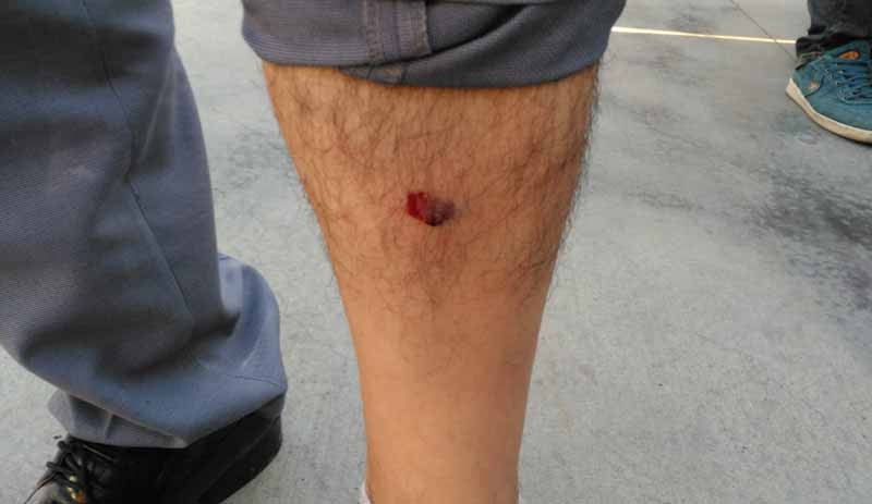 İstanbul'daki 'Demokrasi Nöbeti'ne polis saldırdı - Resim : 1